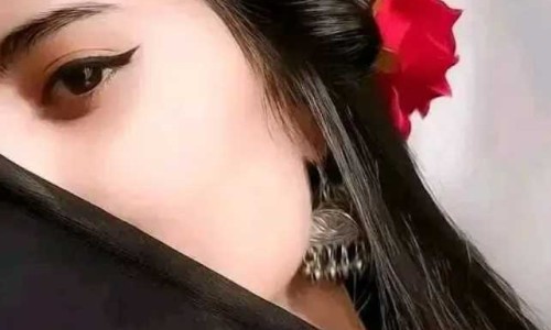 股骨头与髋关节图片网 - 为你提供股骨头塌陷图片、股骨头髋关节置换后多长时间能下地干活